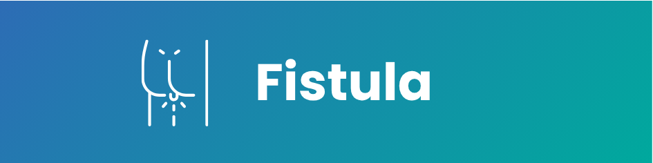 Fistula Treatment at Daya General Hospital